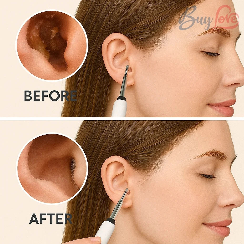 Ear Cleaner Pro – 1080P HD Camera