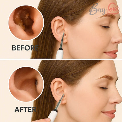 Ear Cleaner Pro – 1080P HD Camera